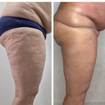 Олена Захарченко, Одеса Фото - 11