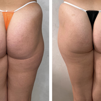 Олена Захарченко, Одеса Фото - 12