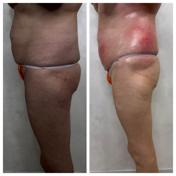 Олена Захарченко, Одеса Фото - 13