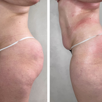 Олена Захарченко, Одеса Фото - 14