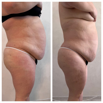 Олена Захарченко, Одеса Фото - 17