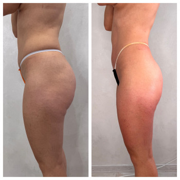 Олена Захарченко, Одеса Фото - 18