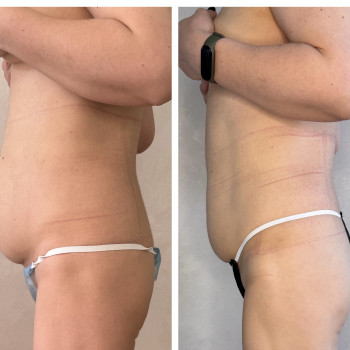 Олена Захарченко, Одеса Фото - 19