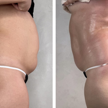 Олена Захарченко, Одеса Фото - 20