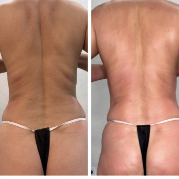 Олена Захарченко, Одеса Фото - 21