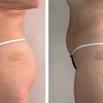 Олена Захарченко, Одеса Фото - 22