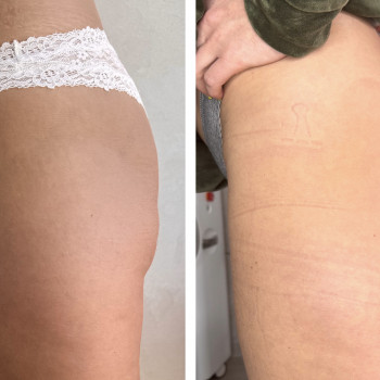 Олена Захарченко, Одеса Фото - 23