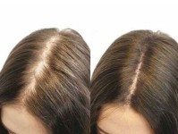 Густе волосся, здорова шкіра голови Масажист Мария Київ