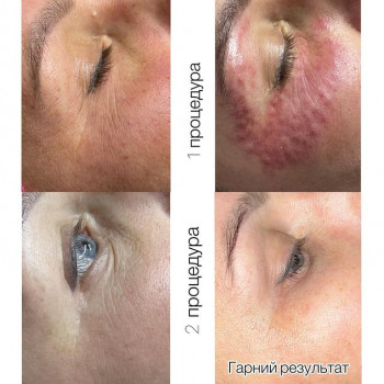 Яна Сницар, Каменец-Подольский Фото - 6