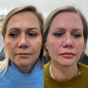 Яна Сницар, Каменец-Подольский Фото - 10