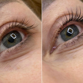 Ельвіра Єршова, Кропивницький Фото - 5