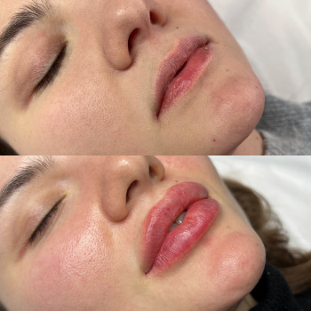 Александра Славко, Днепр Фото - 1