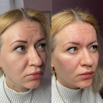 Александра Славко, Днепр Фото - 2