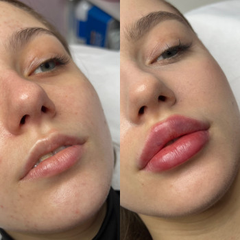 Александра Славко, Днепр Фото - 3