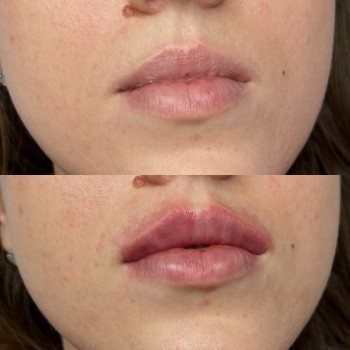 Александра Славко, Днепр Фото - 4