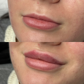 Александра Славко, Днепр Фото - 6