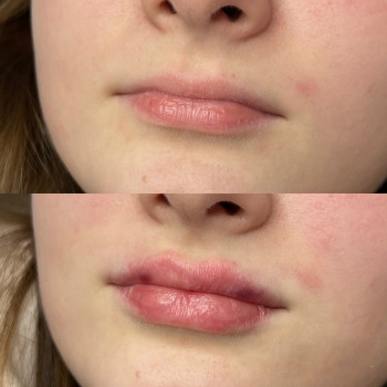 Александра Славко, Днепр Фото - 7