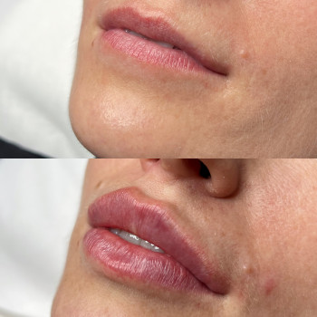 Александра Славко, Днепр Фото - 9