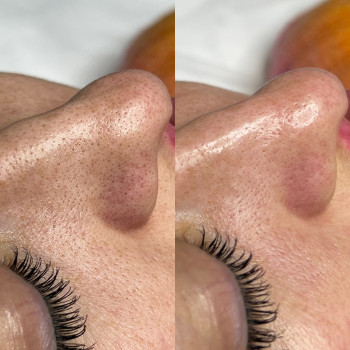 Александра Славко, Днепр Фото - 10