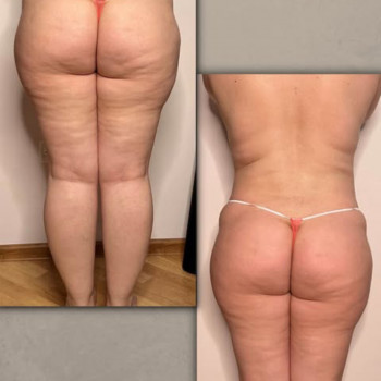 Олександра Чугаєнко, Киев Фото - 6