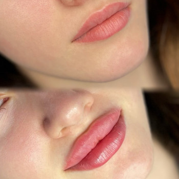 Вікторія Корсюк, Запоріжжя Фото - 12