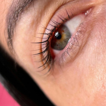 Анна Бурлака, Чернівці Фото - 5