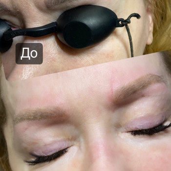 Лазерне видалення тату
                    Майстер перманентного макіяжу Наталья Київ