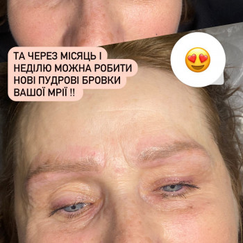 Лазерне видалення тату
                    Майстер перманентного макіяжу Наталья Київ