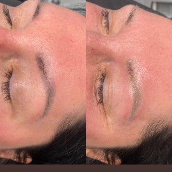 Лазерне видалення тату
                    Майстер перманентного макіяжу Наталья Київ