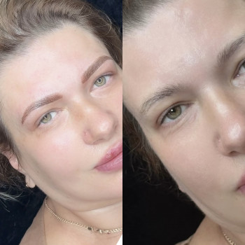 Перманентний макіяж трех зон
                    Мастер перманентного макияжа Наталья Киев