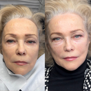 Комплексна робота: як фарбувала б клієнтка і як вона виглядає з ПЕРМАНЕНТОМ трех зон