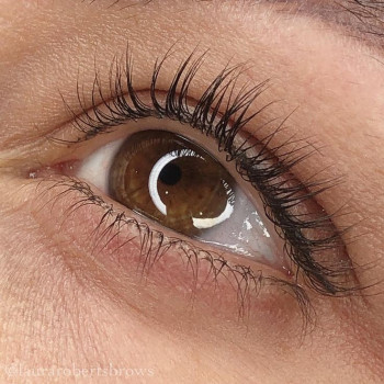 Заживший перманент міжвійкового простору