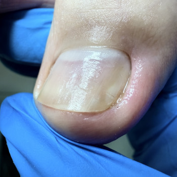 Алена Мазур, Винница Фото - 1