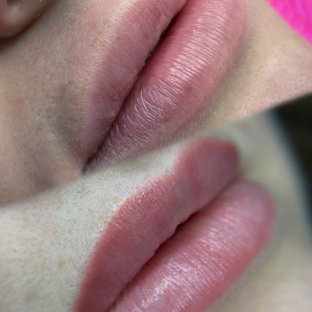 Загоєний перманент губ