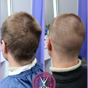 Иленто, Запорожье Фото - 71