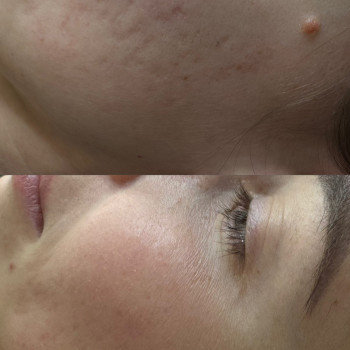 Валентина Єлінська, Київ Фото - 32