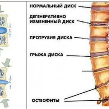 Масаж, психосоматика, мануальная терапия
                    Масажист Камо Эдуардович Одеса