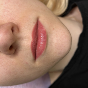 Загоєний перманент