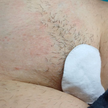 бікіні-середнє