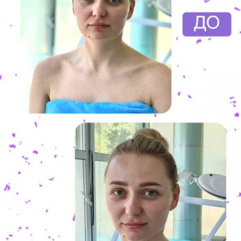 Масаж обличчя