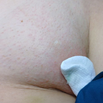 зона бікіні-електро