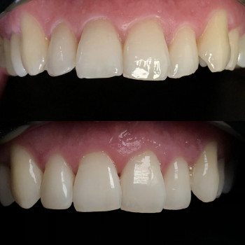 Художня реставрація