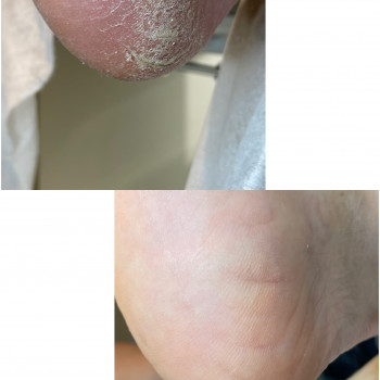 Педикюр
                    Подолог Ксения Киев