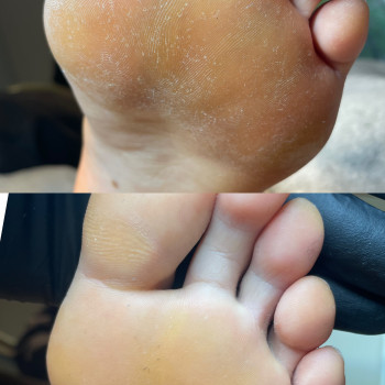 Педикюр
                    Подолог Ксения Киев