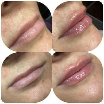 Лариса Петрівна, Луцьк Фото - 8