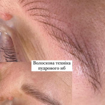 Лидия Матлюк, Ивано-Франковск Фото - 6