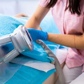 Кріоліполіз рук