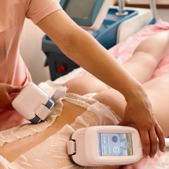 Кріоліполіз бока (спина)