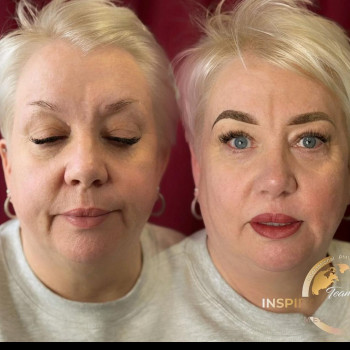 Юлия Мельник, Винница Фото - 1