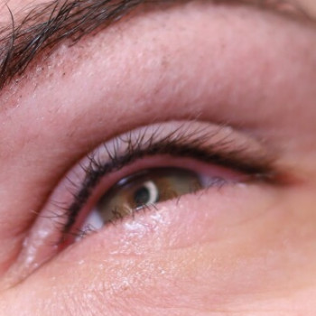 Іванна Дейнега, Рівне Фото - 5